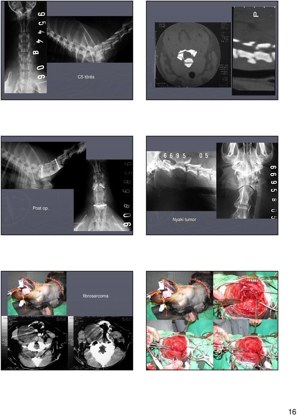 Nyaki tumor