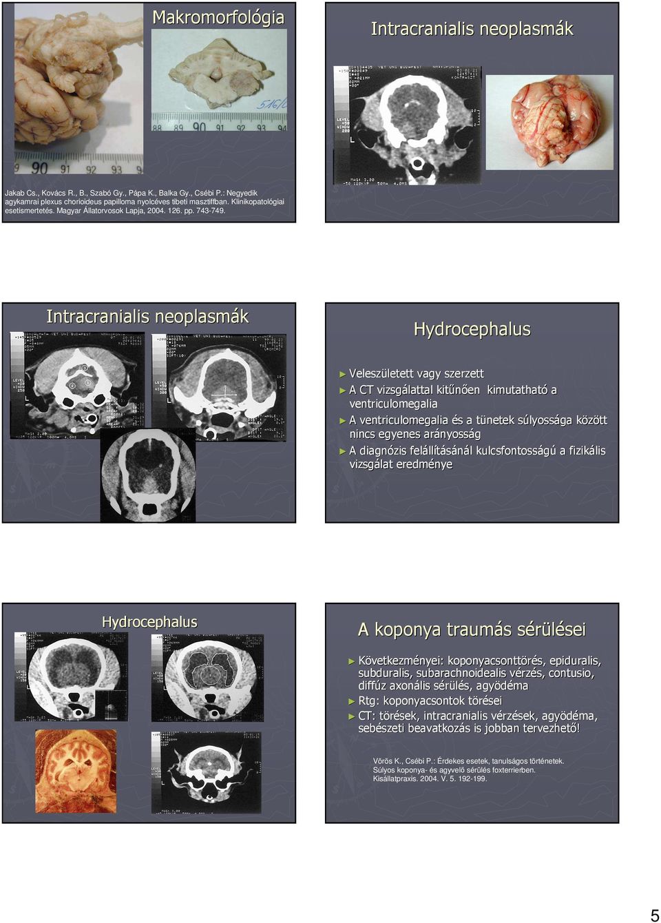 Intracranialis neoplasmák Hydrocephalus Veleszületett vagy szerzett A CT vizsgálattal kitőnıen kimutatható a ventriculomegalia A ventriculomegalia és a tünetek súlyossága között nincs egyenes