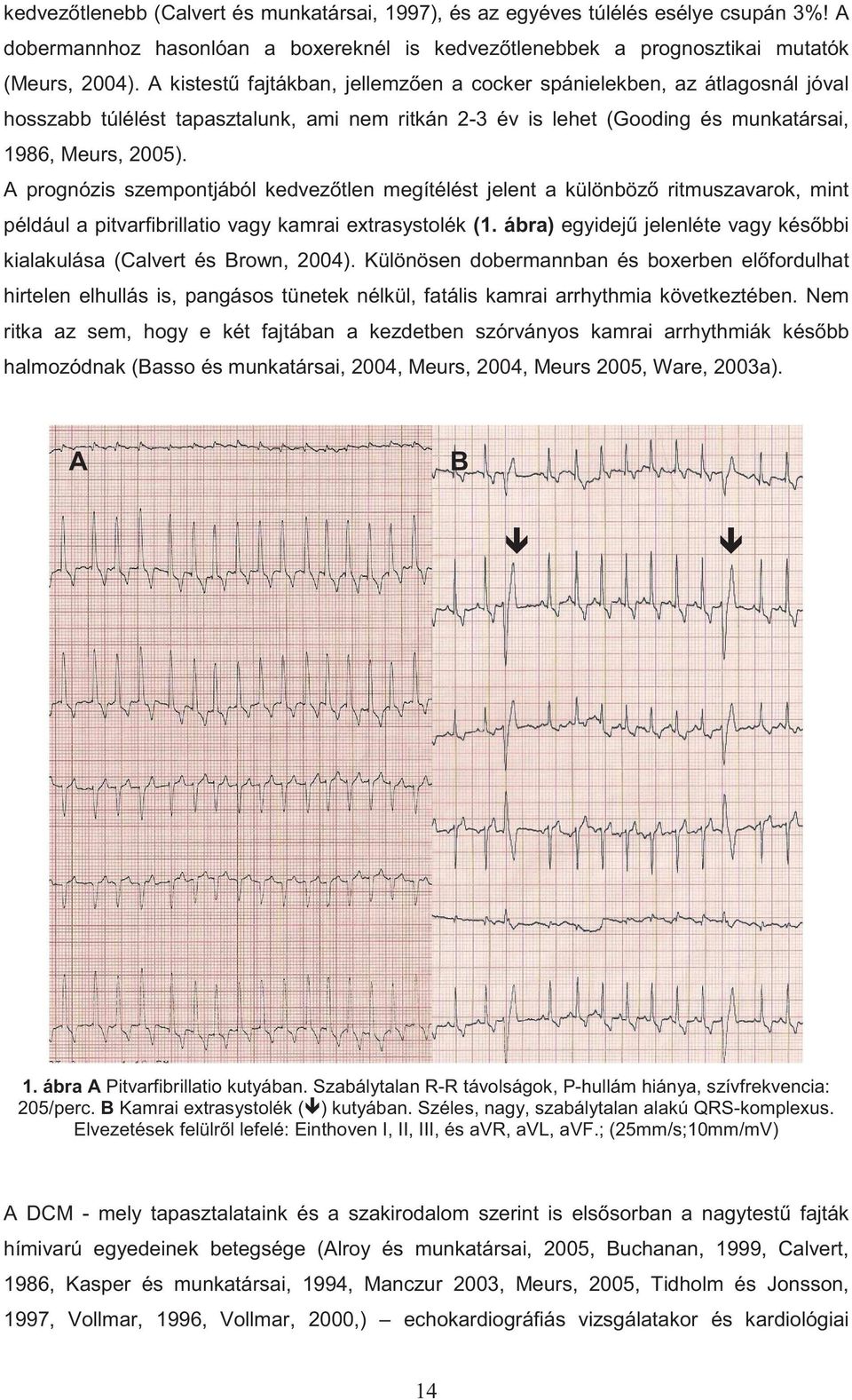 A prognózis szempontjából kedvez tlen megítélést jelent a különböz ritmuszavarok, mint például a pitvarfibrillatio vagy kamrai extrasystolék (1.
