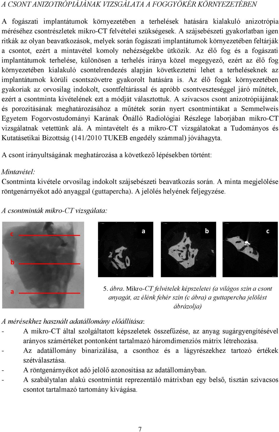 Az élő fog és a fogászati implantátumok terhelése, különösen a terhelés iránya közel megegyező, ezért az élő fog környezetében kialakuló csontelrendezés alapján következtetni lehet a terheléseknek az