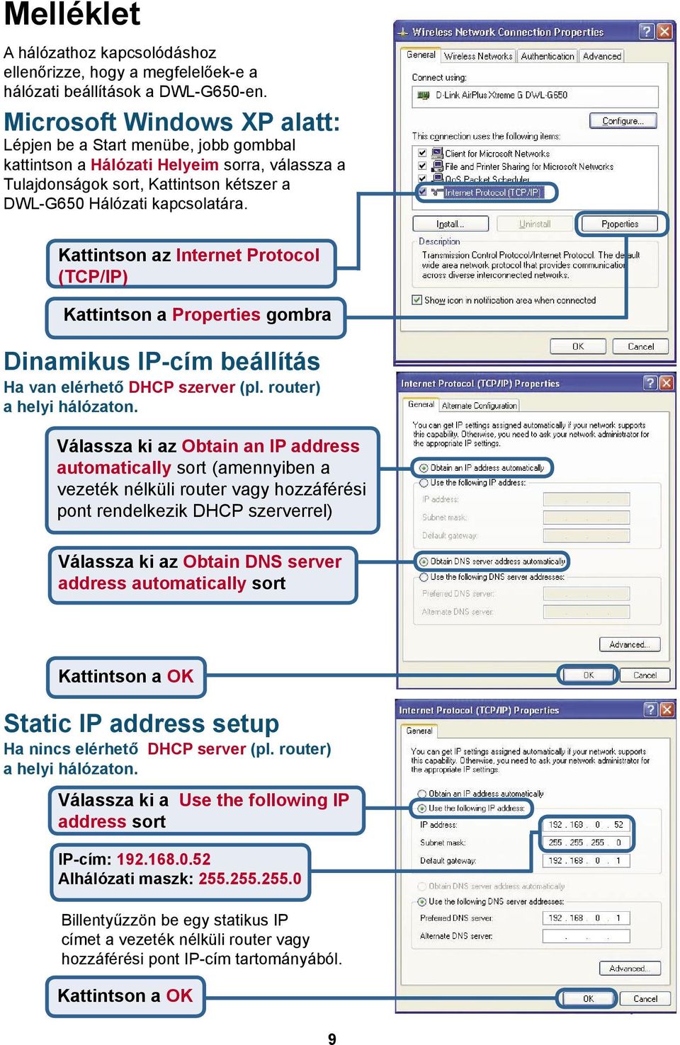 Kattintson az Internet Protocol (TCP/IP) Kattintson a Properties gombra Dinamikus IP-cím beállítás Ha van elérhető DHCP szerver (pl. router) a helyi hálózaton.