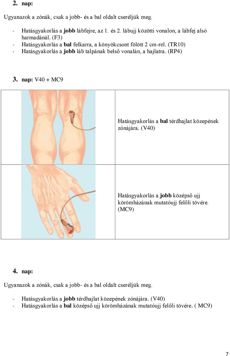 (RP4) 3. nap: V40 + MC9 Hatásgyakorlás a bal térdhajlat közepének zónájára.
