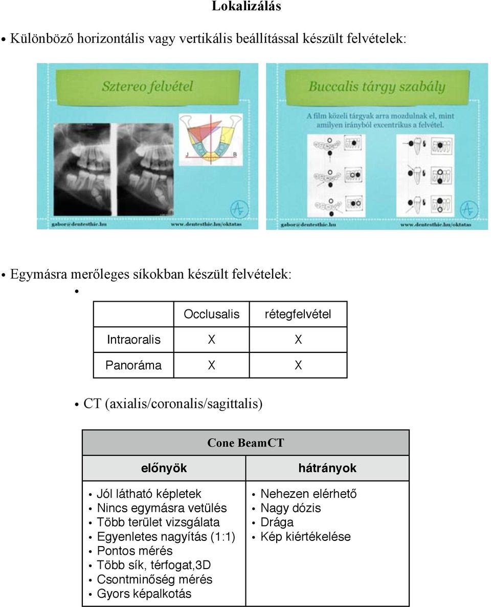 Cone BeamCT Jól látható képletek Nincs egymásra vetülés Több terület vizsgálata Egyenletes nagyítás (1:1)
