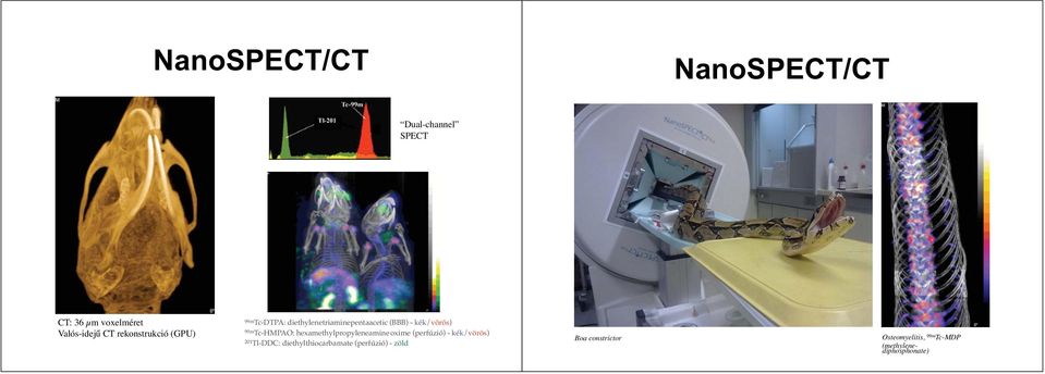 Tc-HMPAO: hexamethylpropyleneamine oxime (perfúzió) - kék/vörös) 201 Tl-DDC: