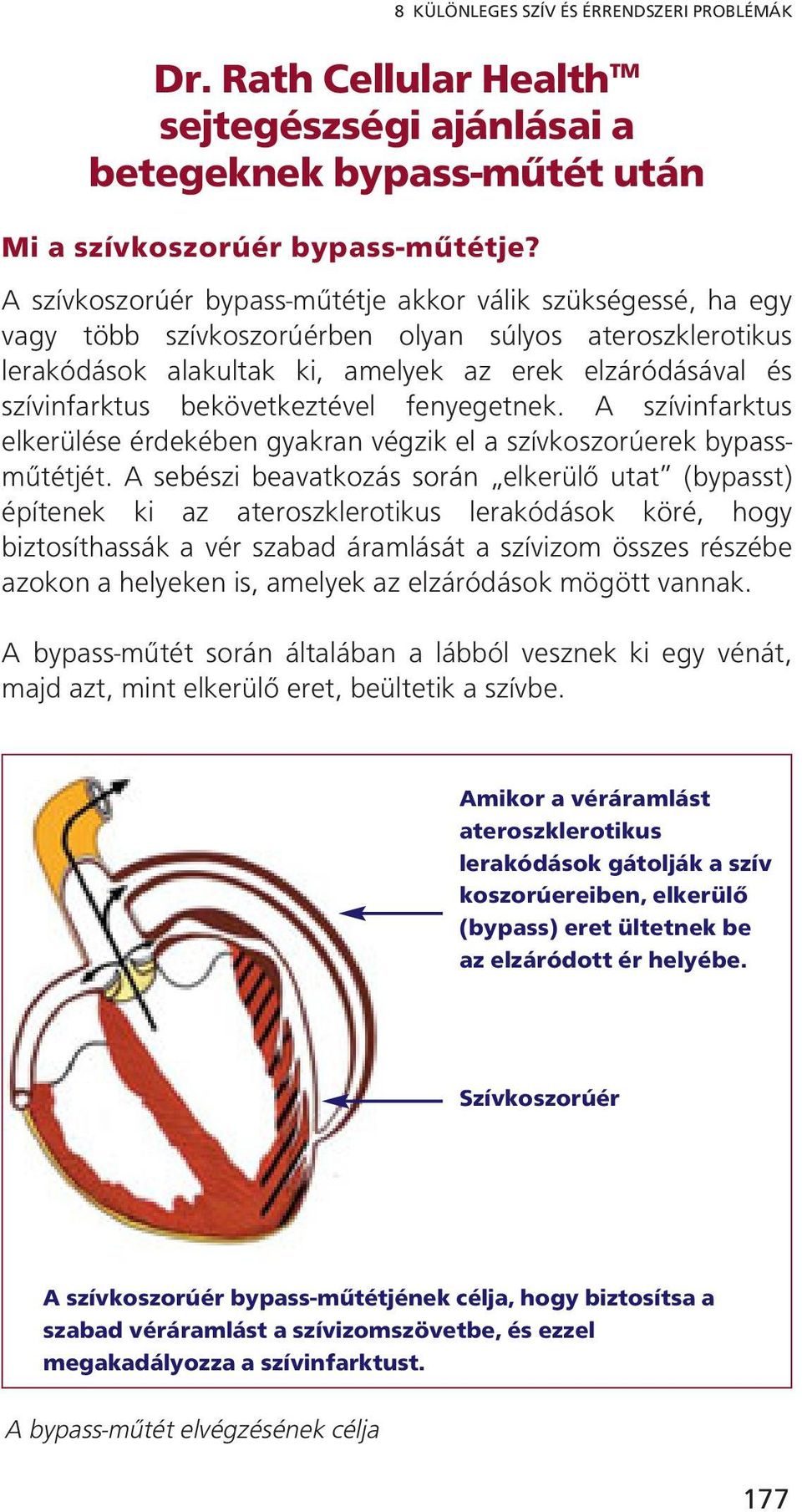 bekövetkeztével fenyegetnek. A szívinfarktus elkerülése érdekében gyakran végzik el a szívkoszorúerek bypassműtétjét.