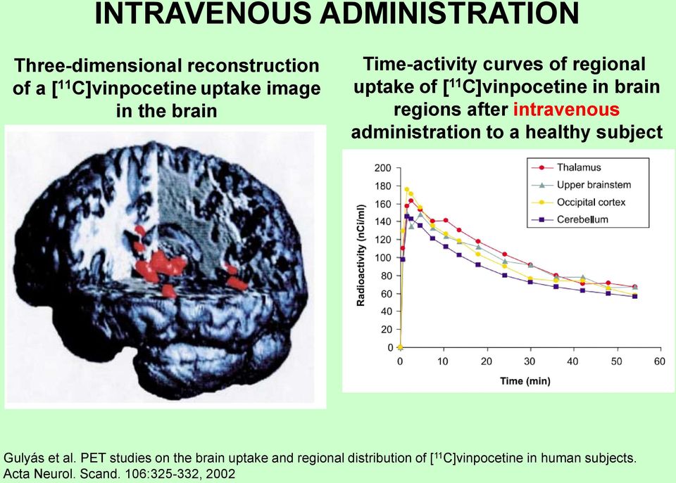 intravenous administration to a healthy subject Gulyás et al.