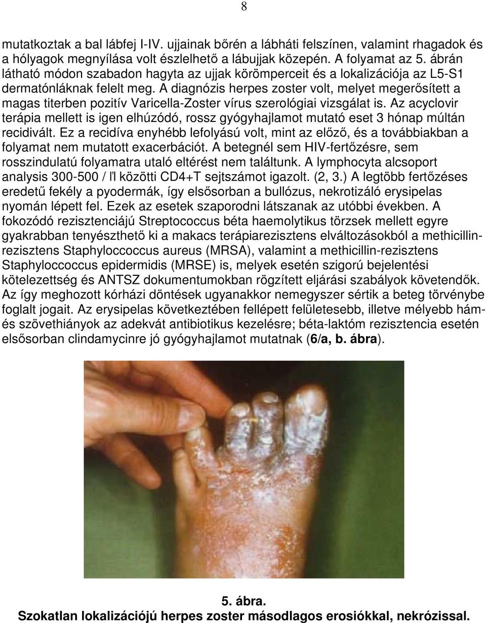 A diagnózis herpes zoster volt, melyet megerısített a magas titerben pozitív Varicella-Zoster vírus szerológiai vizsgálat is.