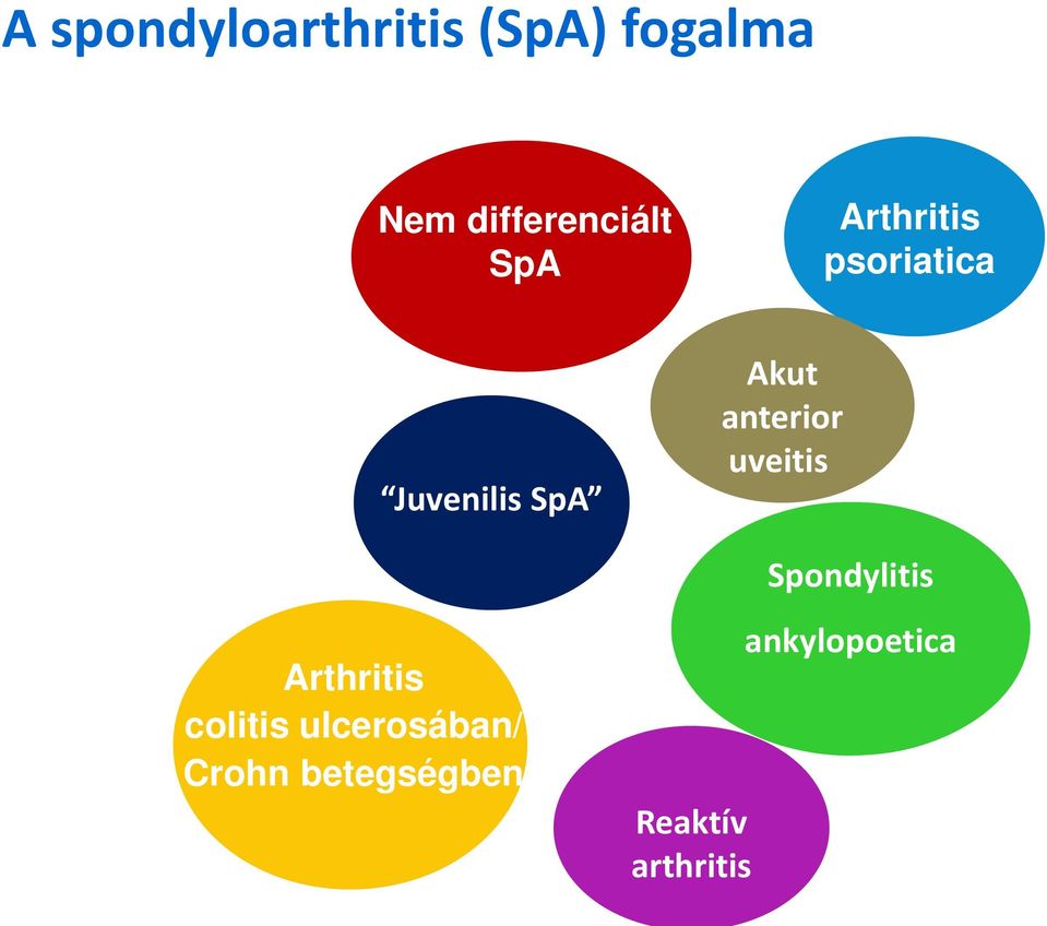 anterior uveitis Spondylitis Arthritis colitis