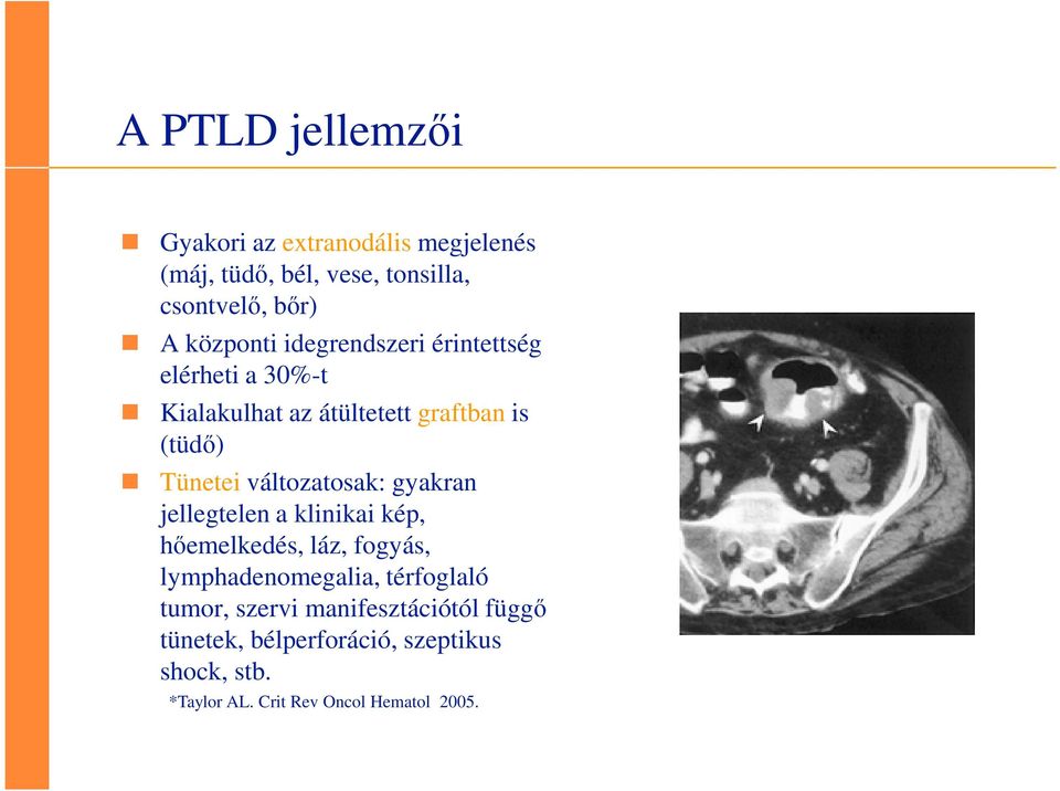 változatosak: gyakran jellegtelen a klinikai kép, hőemelkedés, láz, fogyás, lymphadenomegalia, térfoglaló