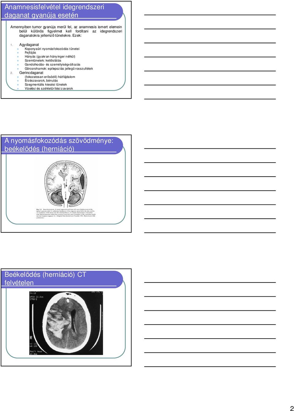 Agydaganat Koponyaőri nyomásfokozódás tünetei Fejfájás Hányás (gy akran hány inger nélkül) Szemtünetek: kettıs látás Gondolkodás- és személyiségváltozás
