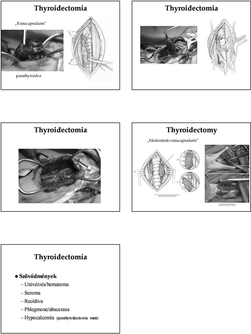 Utóvérzés/hematoma Seroma Recidiva