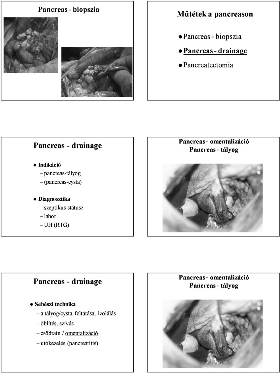 Diagnosztika szeptikus státusz labor UH (RTG) Pancreas - drainage Pancreas - omentalizáció