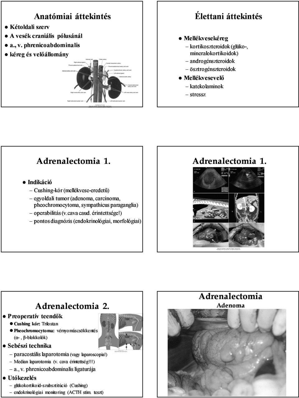 stressz Adrenalectomia 1. Adrenalectomia 1. Cushing-kór (mellékvese-eredetű) eredetű) egyoldali tumor (adenoma adenoma, carcinoma, pheochromocytoma, sympathicus paraganglia) operabilitás (v.cava caud.