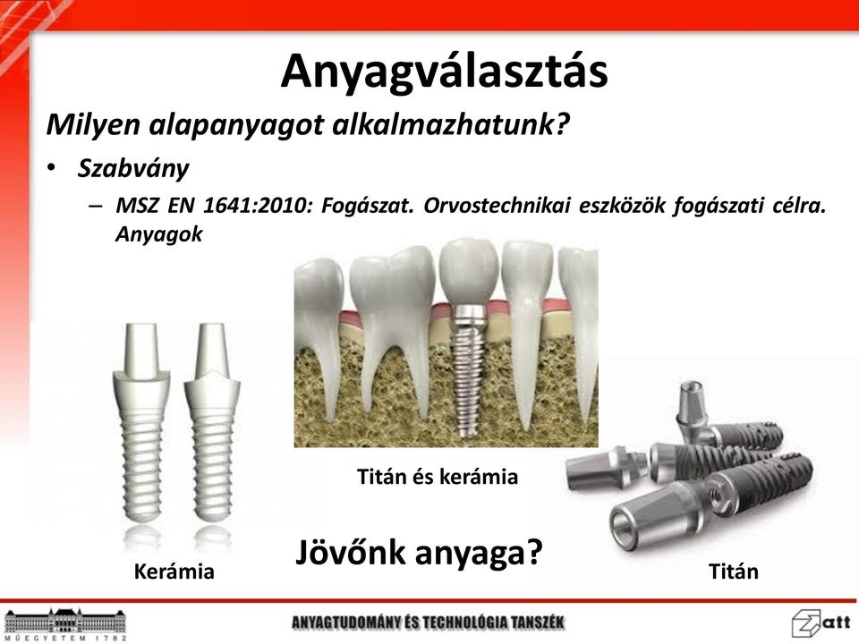 Szabvány MSZ EN 1641:2010: Fogászat.