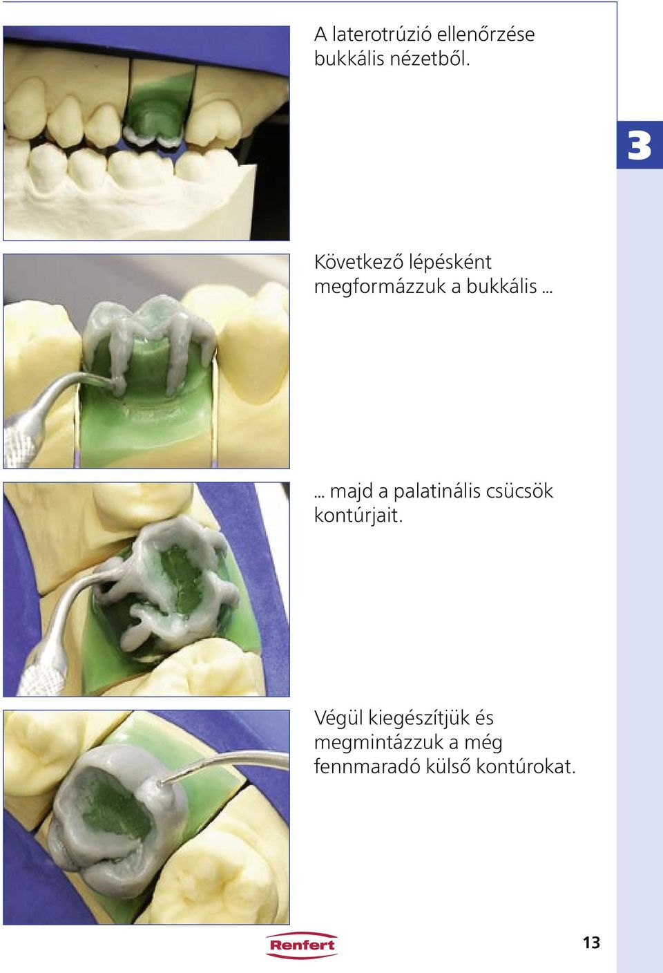 a palatinális csücsök kontúrjait.