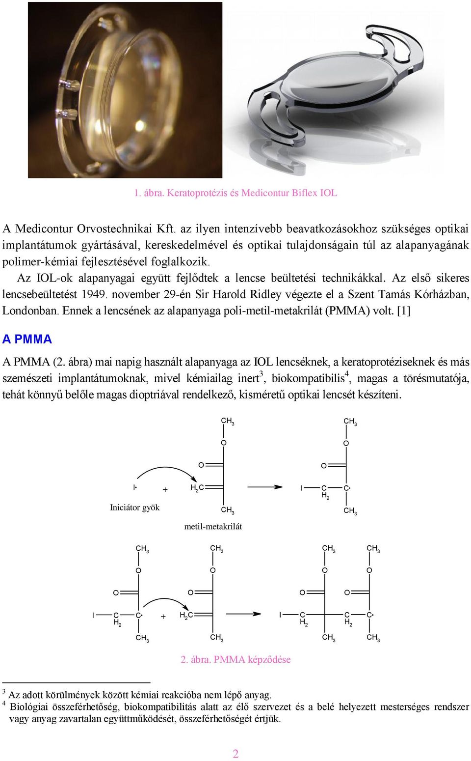 Az IL-ok alapanyagai együtt fejlődtek a lencse beültetési technikákkal. Az első sikeres lencsebeültetést 1949. november 29-én r arold Ridley végezte el a Szent Tamás Kórházban, Londonban.