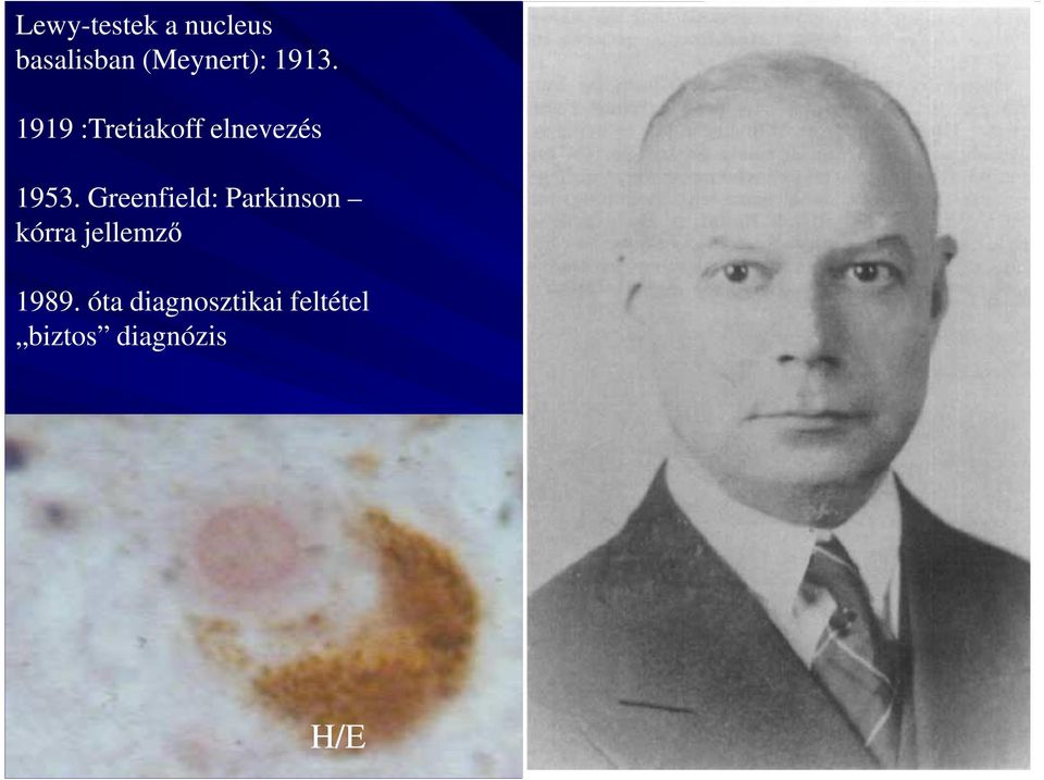 Greenfield: Parkinson kórra jellemző 1989.