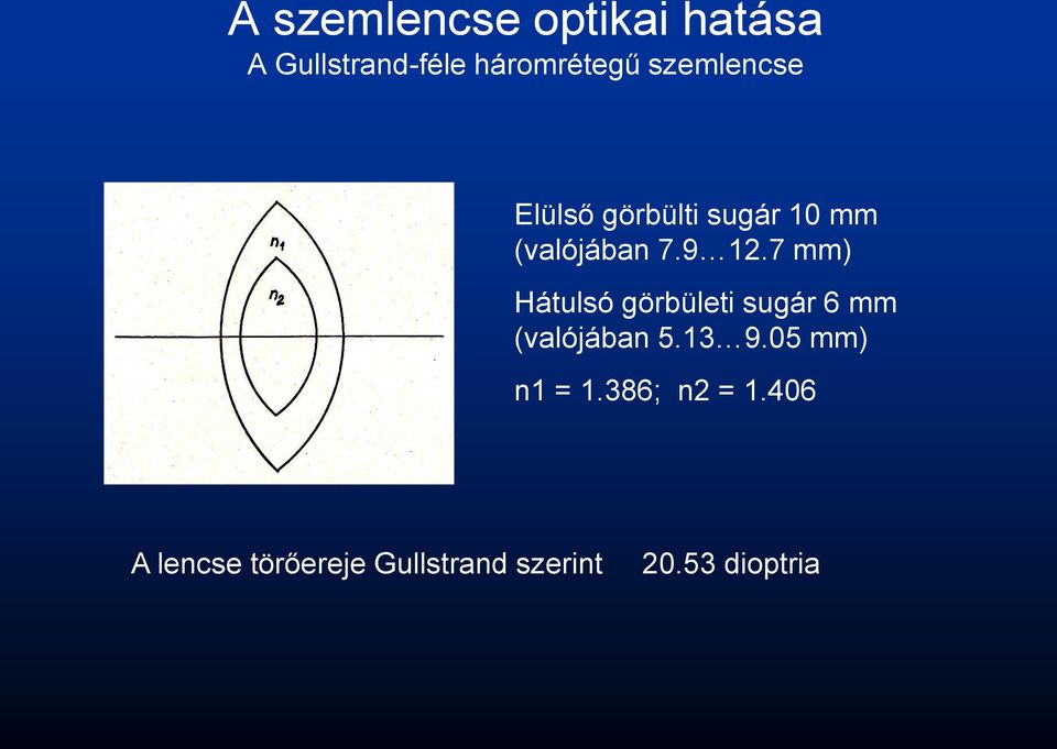 7 mm) Hátulsó görbületi sugár 6 mm (valójában 5.13 9.