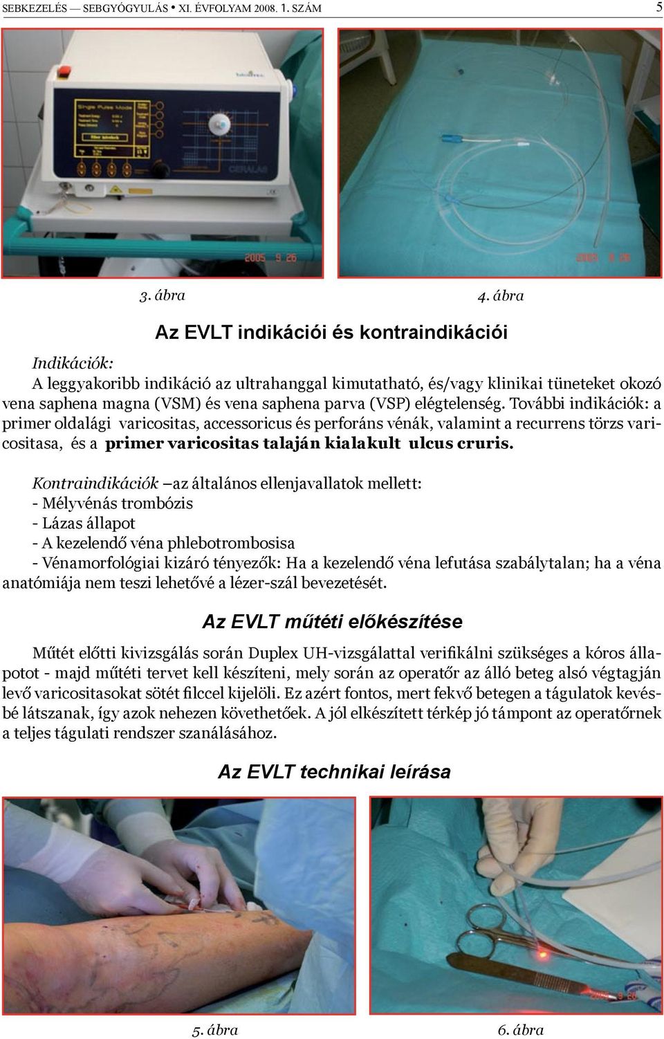 elégtelenség. További indikációk: a primer oldalági varicositas, accessoricus és perforáns vénák, valamint a recurrens törzs varicositasa, és a primer varicositas talaján kialakult ulcus cruris.