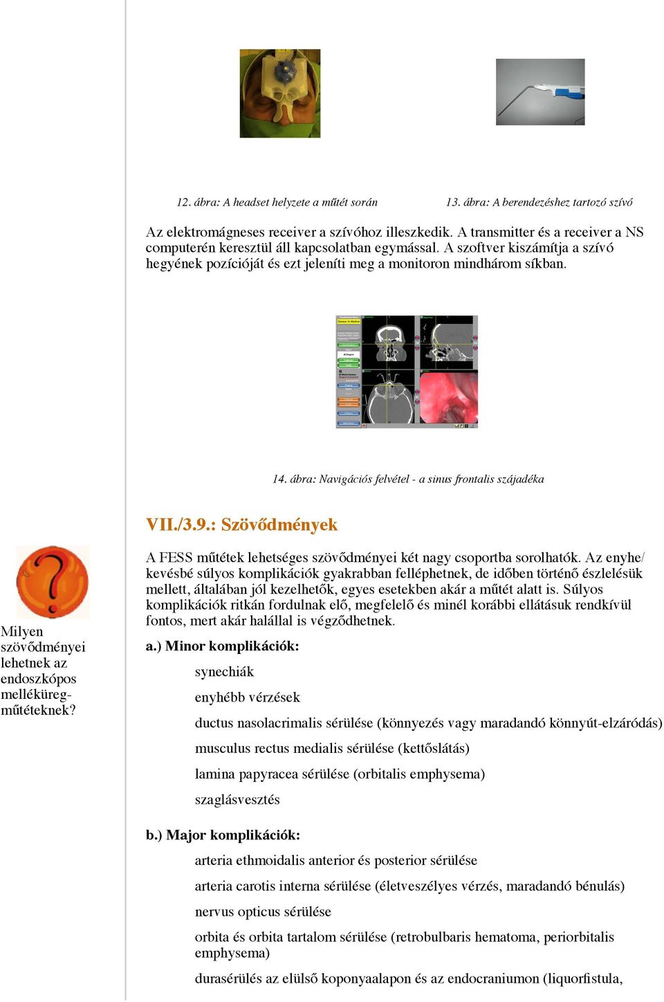 ábra: Navigációs felvétel - a sinus frontalis szájadéka VII./3.9.: Szövődmények Milyen szövődményei lehetnek az endoszkópos melléküregműtéteknek?