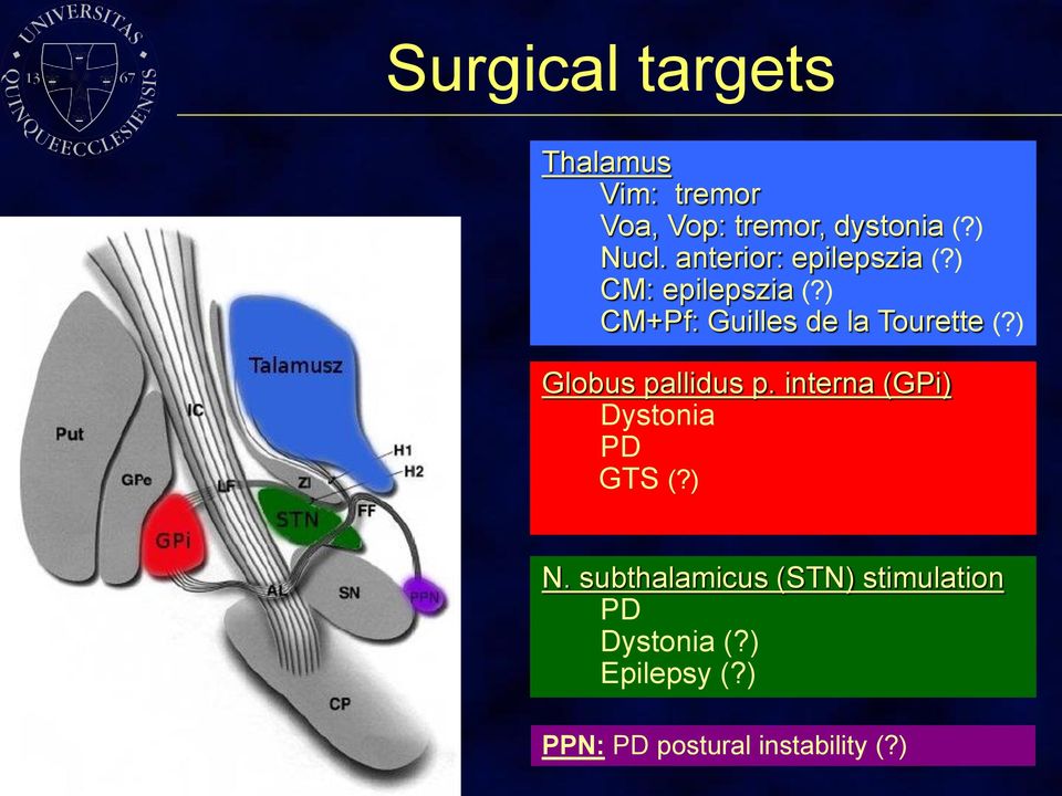 ) Globus pallidus p. interna (GPi) Dystonia PD GTS (?) N.