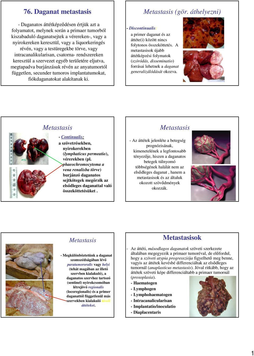 független, secunder tumoros implantatumokat, fiókdaganatokat alakítanak ki. Metastasis (gör. áthelyezni) - Discontinualis: a primer daganat és az áttéte(i) között nincs folytonos összeköttetés.