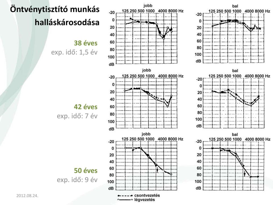 idő: 1,5 év Halláskárosodás 42 éves exp.