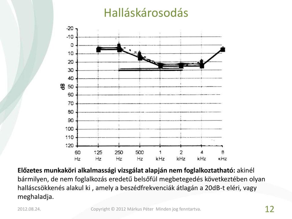 belsőfül megbetegedés következtében olyan halláscsökkenés alakul