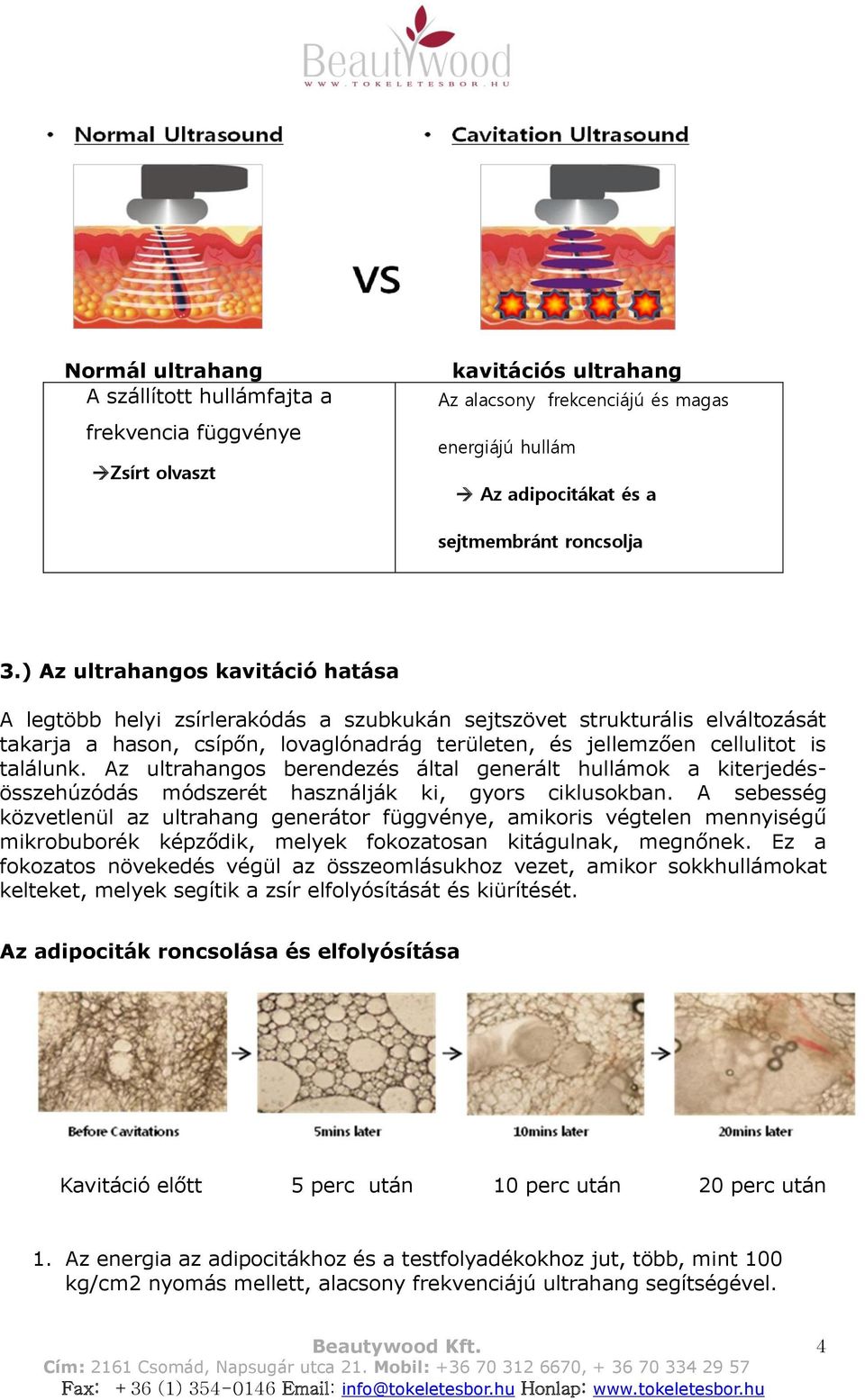 Az ultrahangos berendezés által generált hullámok a kiterjedésösszehúzódás módszerét használják ki, gyors ciklusokban.