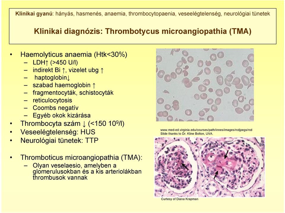 Egyéb okok kizárása Thrombocyta szám (<150 10 9 /l) Veseelégtelenség: HUS Neurológiai tünetek: TTP www.med-ed.virginia.