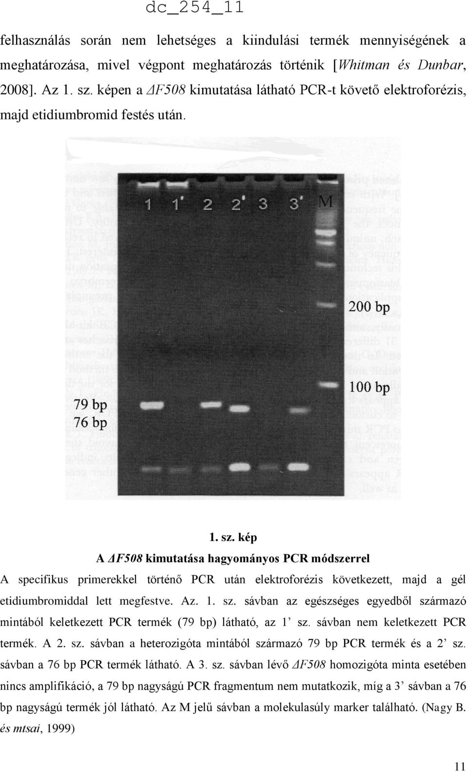 kép A ΔF508 kimutatása hagyományos PCR módszerrel A specifikus primerekkel történő PCR után elektroforézis következett, majd a gél etidiumbromiddal lett megfestve. Az. 1. sz.