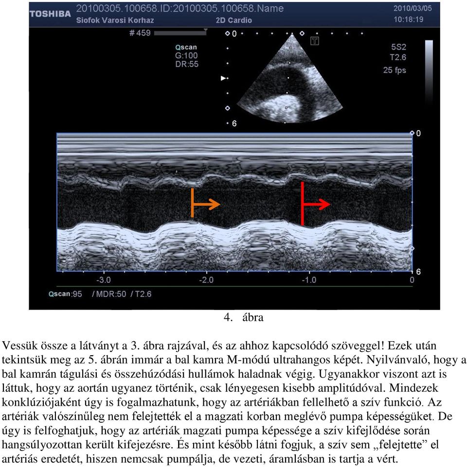 Mindezek konklúziójaként úgy is fogalmazhatunk, hogy az artériákban fellelhető a szív funkció. Az artériák valószínűleg nem felejtették el a magzati korban meglévő pumpa képességüket.