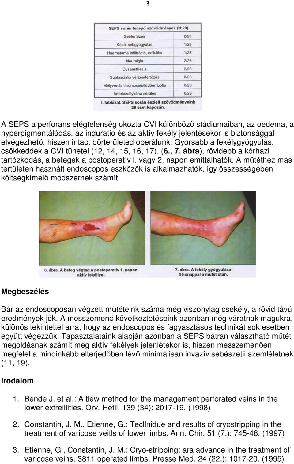 vagy 2, napon emittálhatók. A mőtéthez más tertületen használt endoscopos eszközök is alkalmazhatók, így összességében költségkímélı módszernek számít.