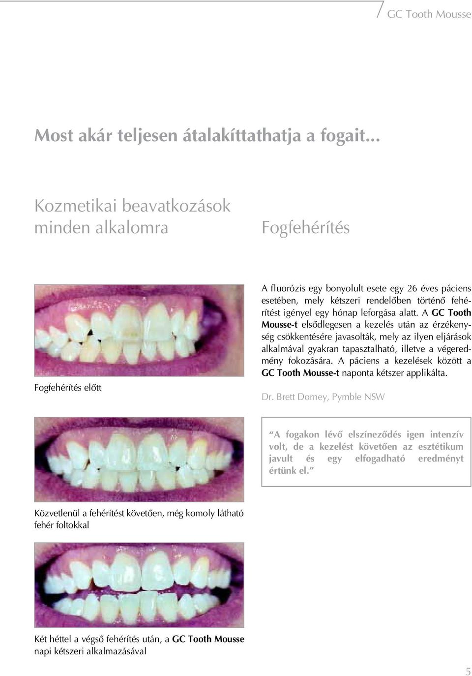 GC Tooth Mousse. Portfolió - PDF Free Download