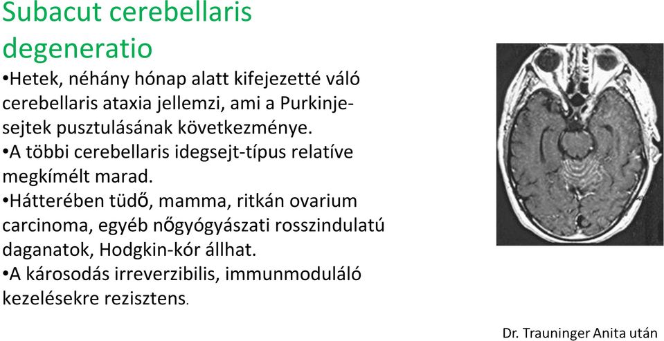 A többi cerebellaris idegsejt-típus relatíve megkímélt marad.