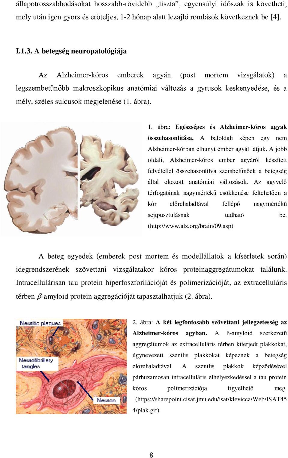 megjelenése (1. ábra). 1. ábra: Egészséges és Alzheimer-kóros agyak összehasonlítása. A baloldali képen egy nem Alzheimer-kórban elhunyt ember agyát látjuk.
