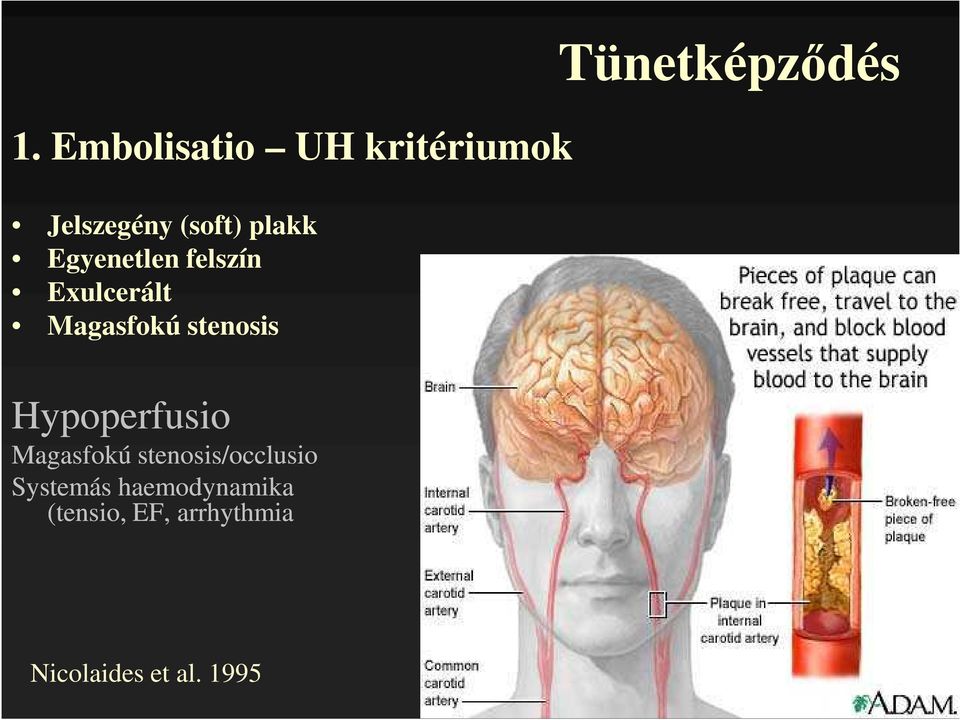 Hypoperfusio Magasfokú stenosis/occlusio Systemás