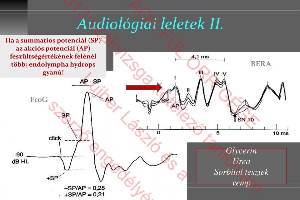 potenciál (AP) feszültségértékének felénél