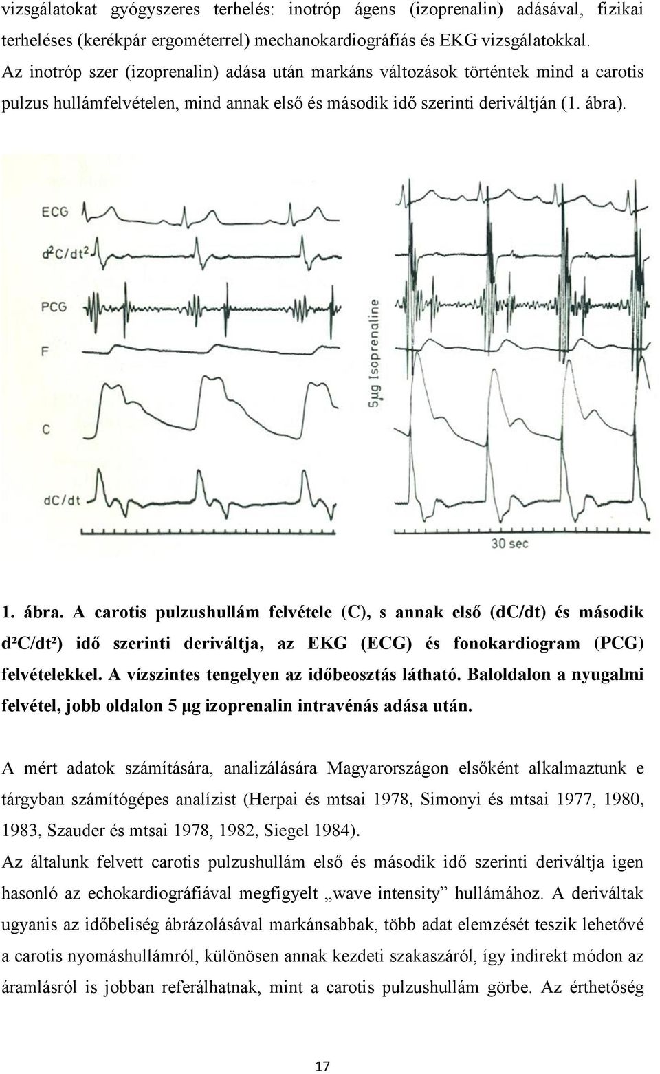 . 1. ábra. A carotis pulzushullám felvétele (C), s annak első (dc/dt) és második d²c/dt²) idő szerinti deriváltja, az EKG (ECG) és fonokardiogram (PCG) felvételekkel.