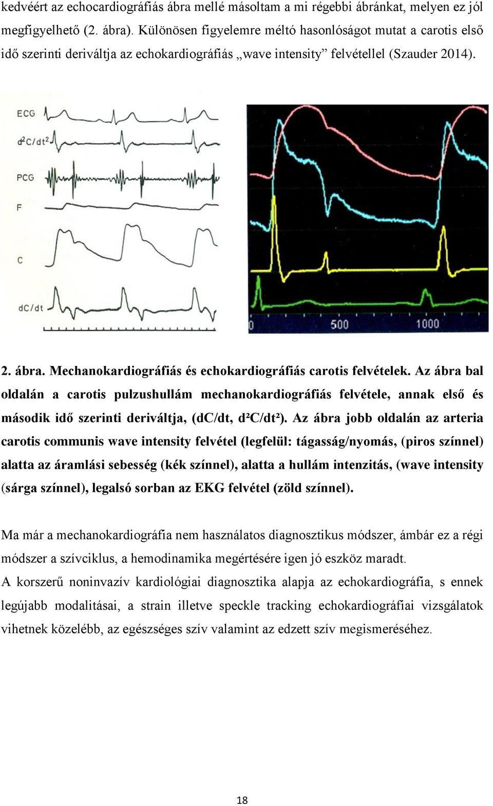 Mechanokardiográfiás és echokardiográfiás carotis felvételek.