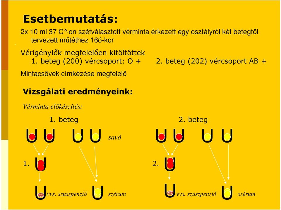 beteg (202) vércsoport AB + Mintacsövek címkézése megfelelı Vizsgálati eredményeink: Vérminta