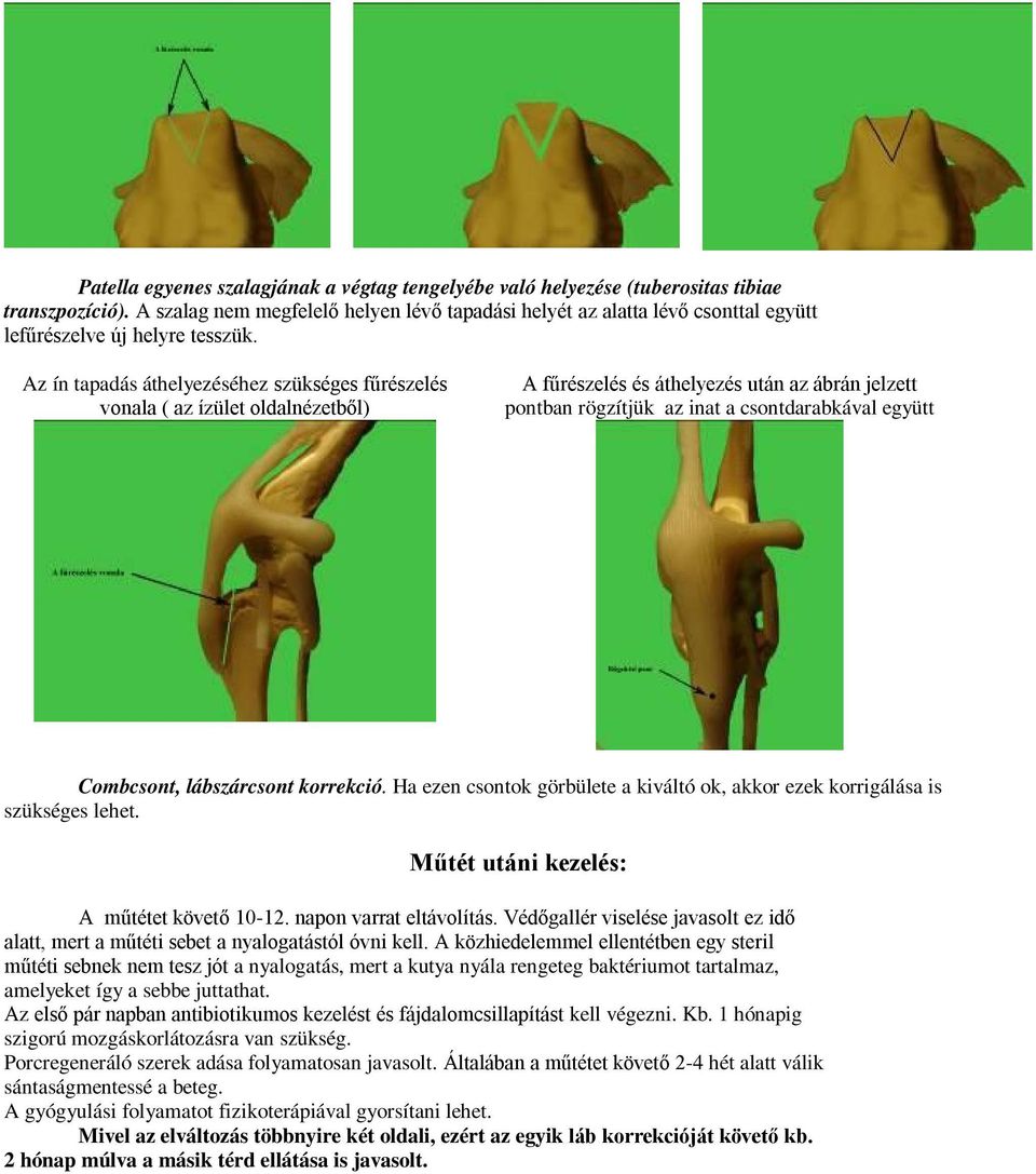 Az ín tapadás áthelyezéséhez szükséges fűrészelés vonala ( az ízület oldalnézetből) A fűrészelés és áthelyezés után az ábrán jelzett pontban rögzítjük az inat a csontdarabkával együtt Combcsont,