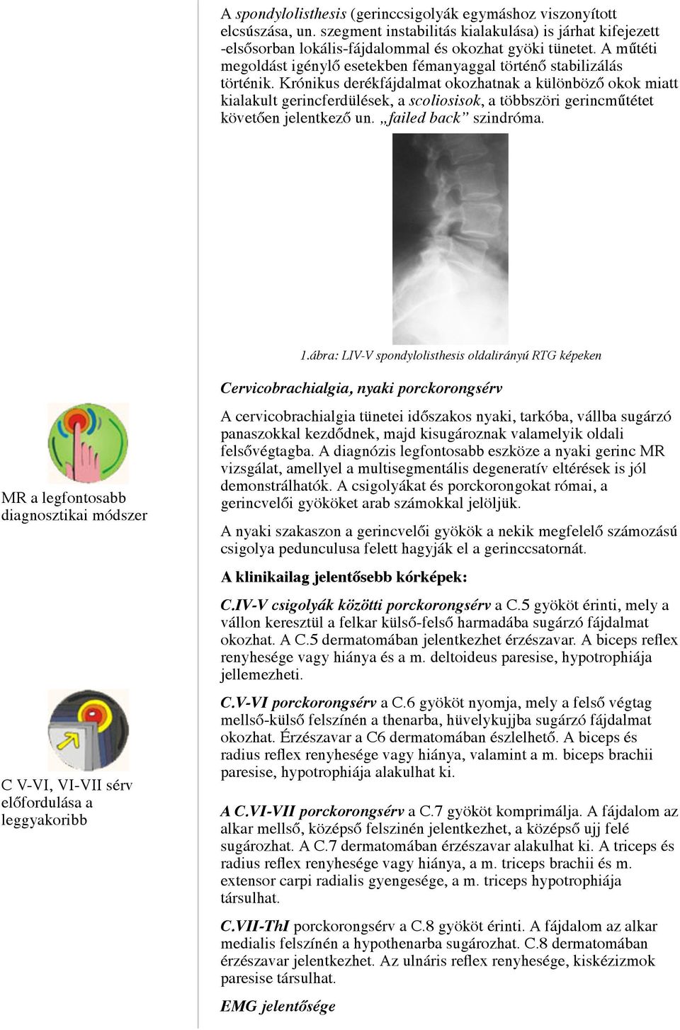 Krónikus derékfájdalmat okozhatnak a különböző okok miatt kialakult gerincferdülések, a scoliosisok, a többszöri gerincműtétet követően jelentkező un. failed back szindróma. 1.