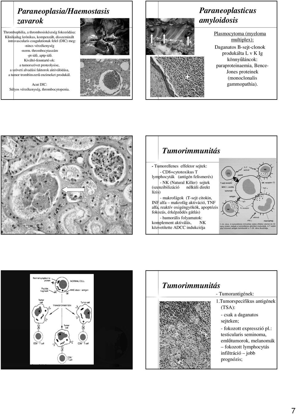 Acut DIC: Súlyos vérzékenység, thrombocytopenia.