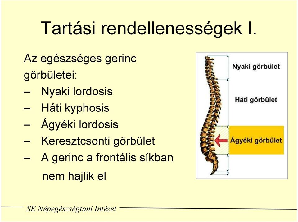 lordosis Háti kyphosis Ágyéki lordosis