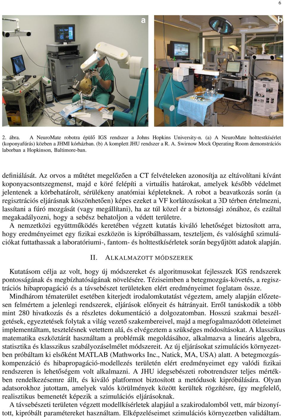 Az orvos a mu tétet megelo zo en a CT felvételeken azonosítja az eltávolítani kívánt koponyacsontszegmenst, majd e köré felépíti a virtuális határokat, amelyek késo bb védelmet jelentenek a