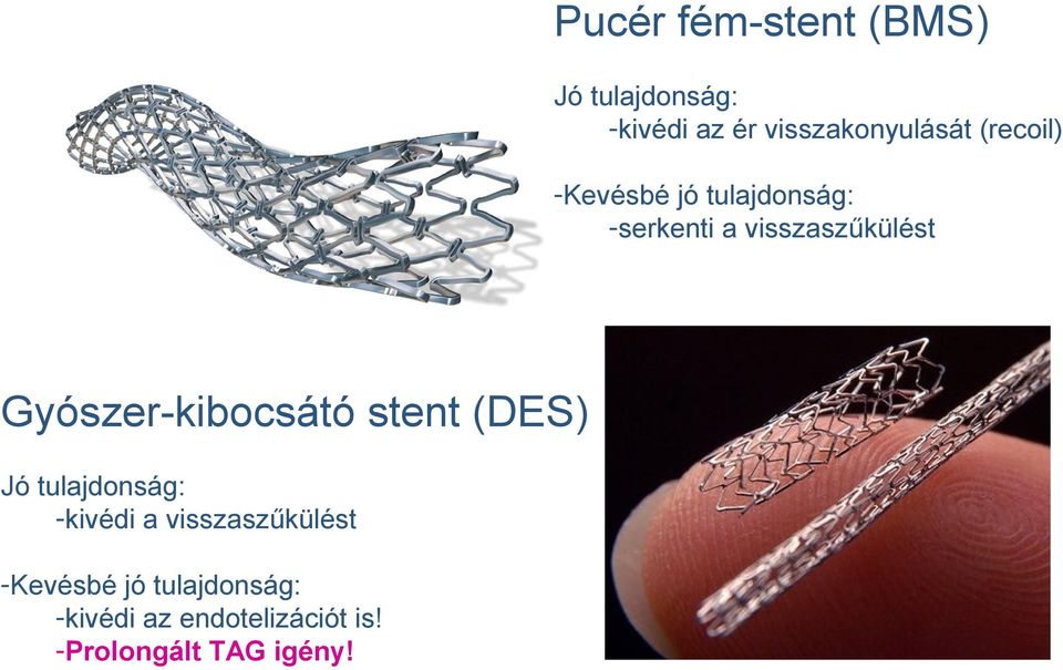 Gyószer-kibocsátó stent (DES) Jó tulajdonság: -kivédi a