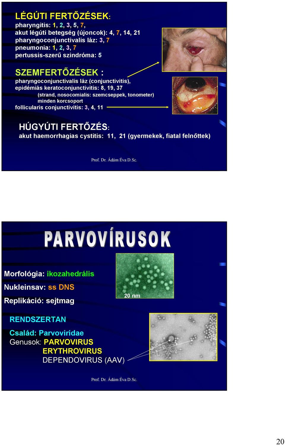 szemcseppek, tonometer) minden korcsoport follicularis conjunctivitis: 3, 4, 11 HÚGYÚTI FERTİZÉS: akut haemorrhagias cystitis: 11, 21 (gyermekek, fiatal