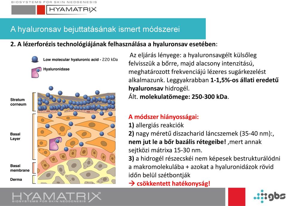 meghatározott frekvenciájú lézeres sugárkezelést alkalmazunk. Leggyakrabban 1-1,5%-os állati eredetű hyaluronsav hidrogél. Ált. molekulatömege: 250-300 kda.