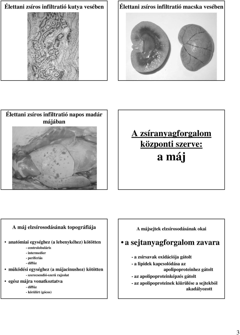 májacinushoz) kötötten - szerecsendió-szerő rajzolat egész májra vonatkoztatva - diffúz - körülírt (gócos) A májsejtek elzsírosodásának okai a sejtanyagforgalom zavara -